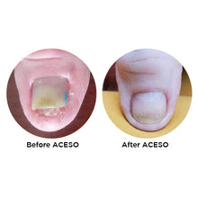 Load image into Gallery viewer, Famous Names Aceso Client Kit 14.8ml Step One & Step Two 60ml Debrider