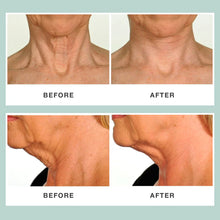 Load image into Gallery viewer, Contours Rx Neck Rescue 30 Strips
